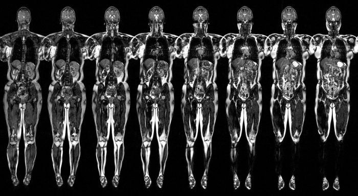 МРТ снимок всего тела